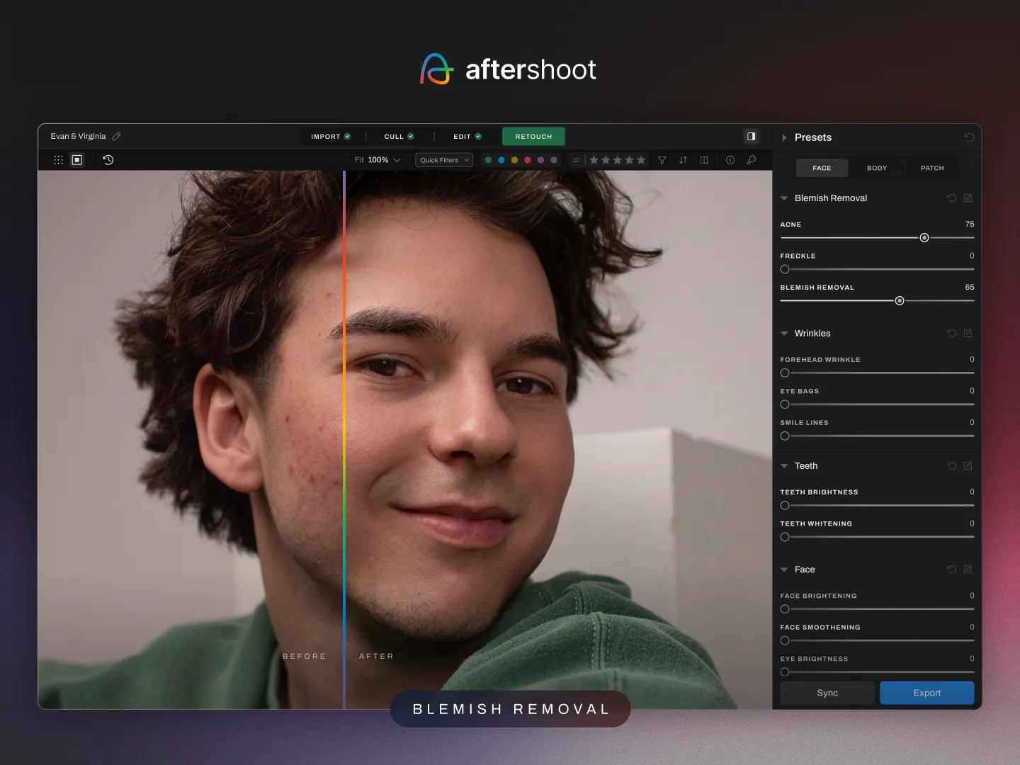 Blemish Removal — Aftershoot AI Retouching